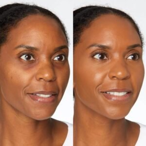 CONCEALER TARTE RADIANT 53N DEEP 10ml - كونسيلر شارب تيب من تارت