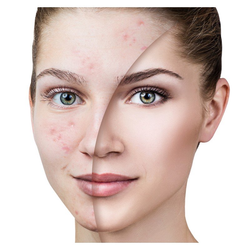 Sephora Beauty Touch mask 50ml Gomme ماسك تنقية البشرة بخلاصة النعناع - Image 4