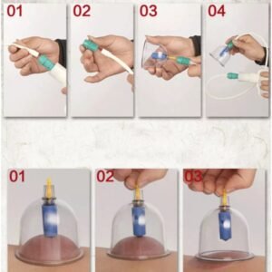 طقم الحجامة 0073